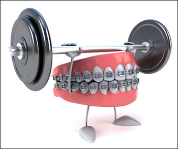 Invisalign-or-Braces