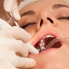 Sedation Dentistry – What You Need to Know Sedation-Dentistry