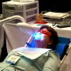 5 Best Teeth Whitening Tips for Adults Teeth Whitening