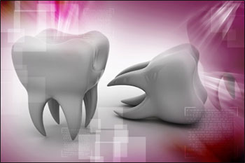 Unlike metal amalgams, composite fillings are tooth-colored and blend in well with your smile